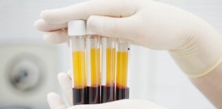fokusjabar.id plasma konvalesen PMI Bandung