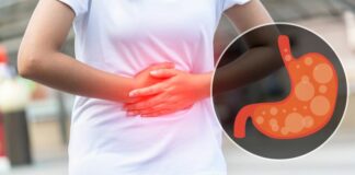 penyakit fokusjabar.id