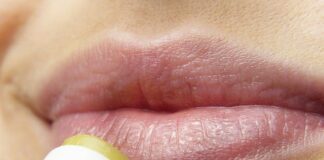 5 Hal Yang Menjadi Penyebab Bibir Bengkak, Wajib Diperhatikan