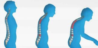 4 Kebiasaan yang Menjadi Penyebab Osteoporosis, Anda Wajib Tahu