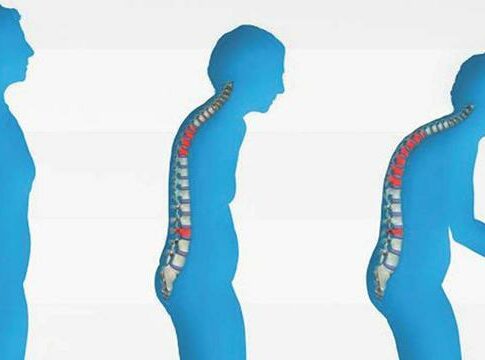 4 Kebiasaan yang Menjadi Penyebab Osteoporosis, Anda Wajib Tahu
