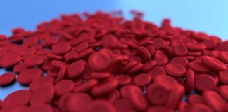 Selain Perbanyak Konsumsi Zat Besi, Berikut 6 Cara Atasi Anemia yang Wajib Anda Tahu