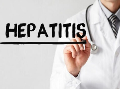 hepatitis akut