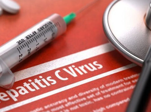 hepatitis akut misterius