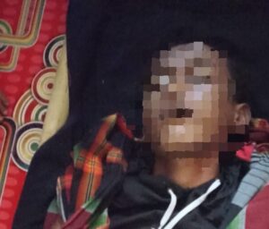 rapi tersambarpetir fokusjabar.id