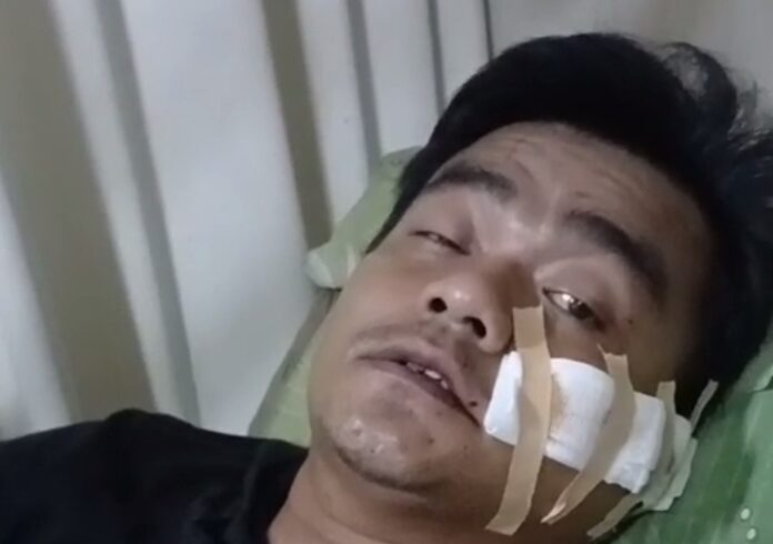 Caption: Pengemudi GrabCar di Banjar Dibacok Orang Tak Dikenal. Banjar, FOKUSJabar.id