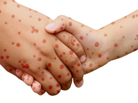 Kemenkes RI fokusjabar.id