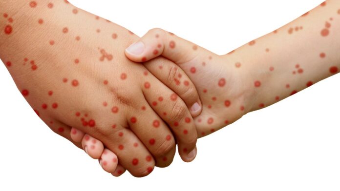 Kemenkes RI fokusjabar.id