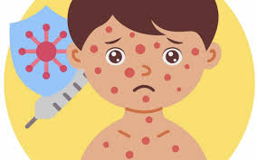 Bandung, FOKUSJabar.id