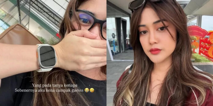 Ruce Nuenda fokusabar.id