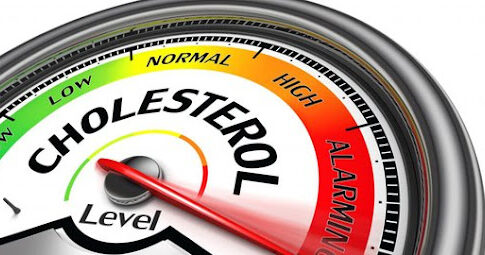 makanan bersantan Kolesterol fokusjabar.id